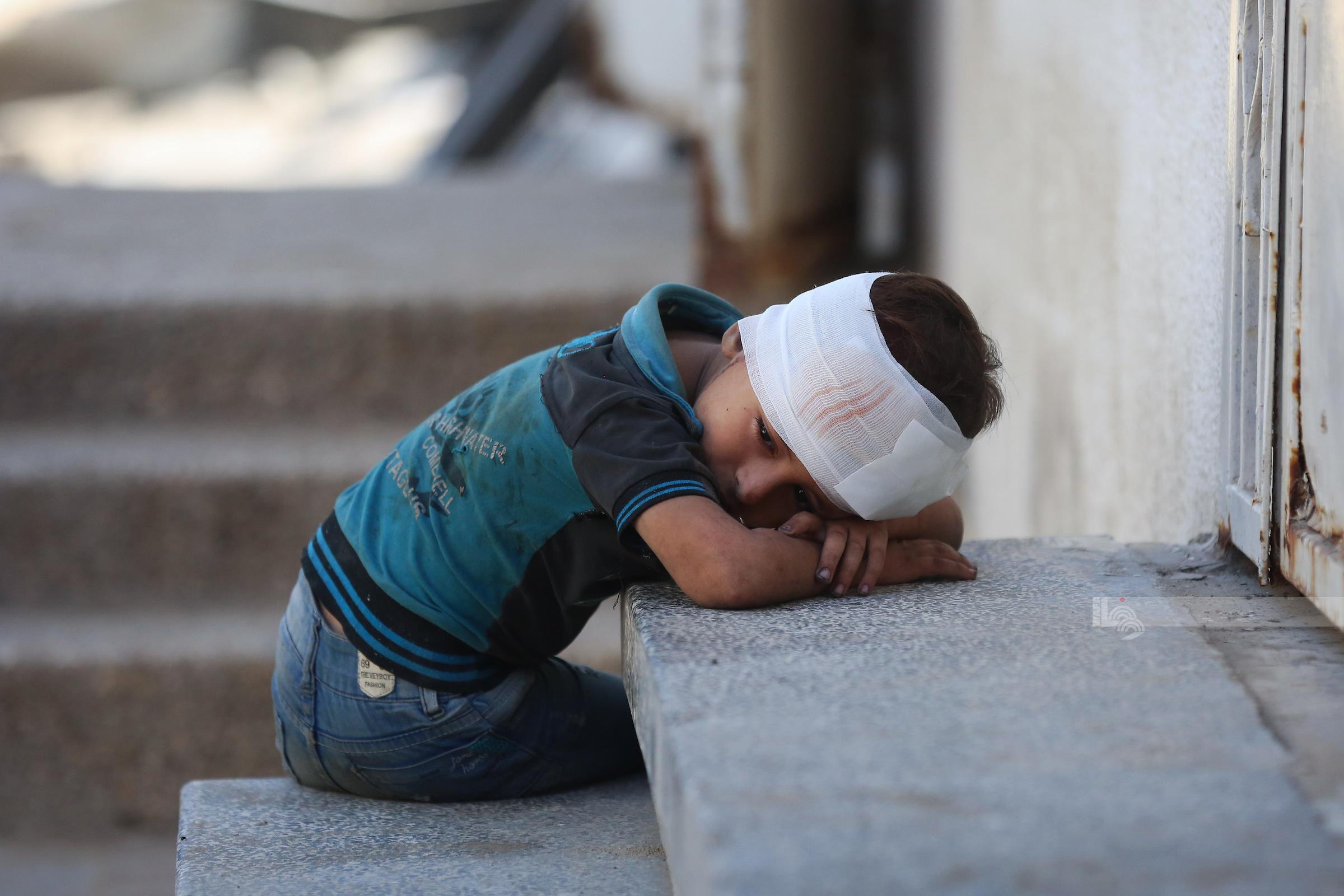 طفل مصاب في ساحة مستشفى الشفاء بمدينة غزة خلال وداع عدد من جثامين الشهداء (وفا)